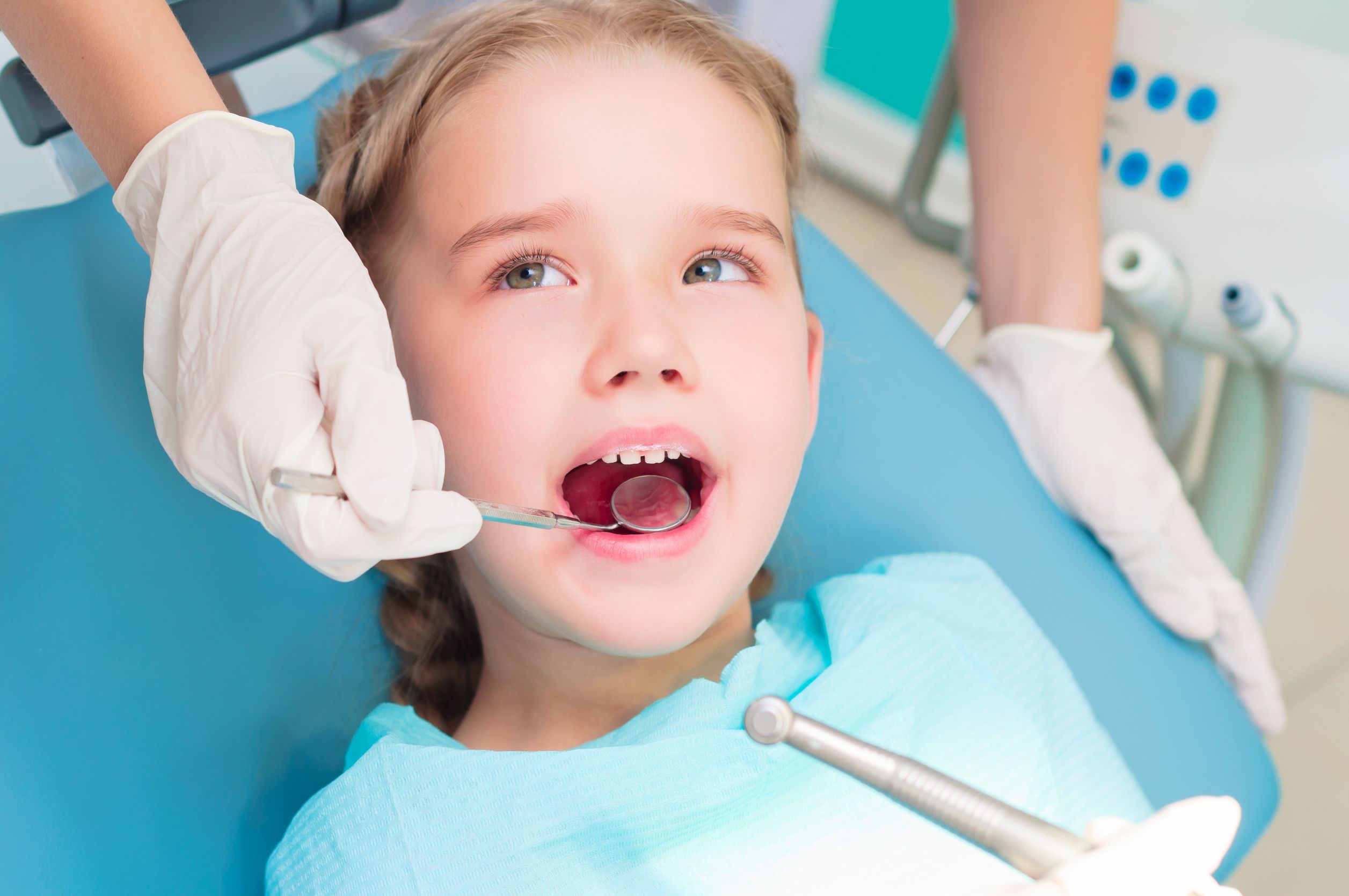 Hiện tượng sâu răng ở trẻ em