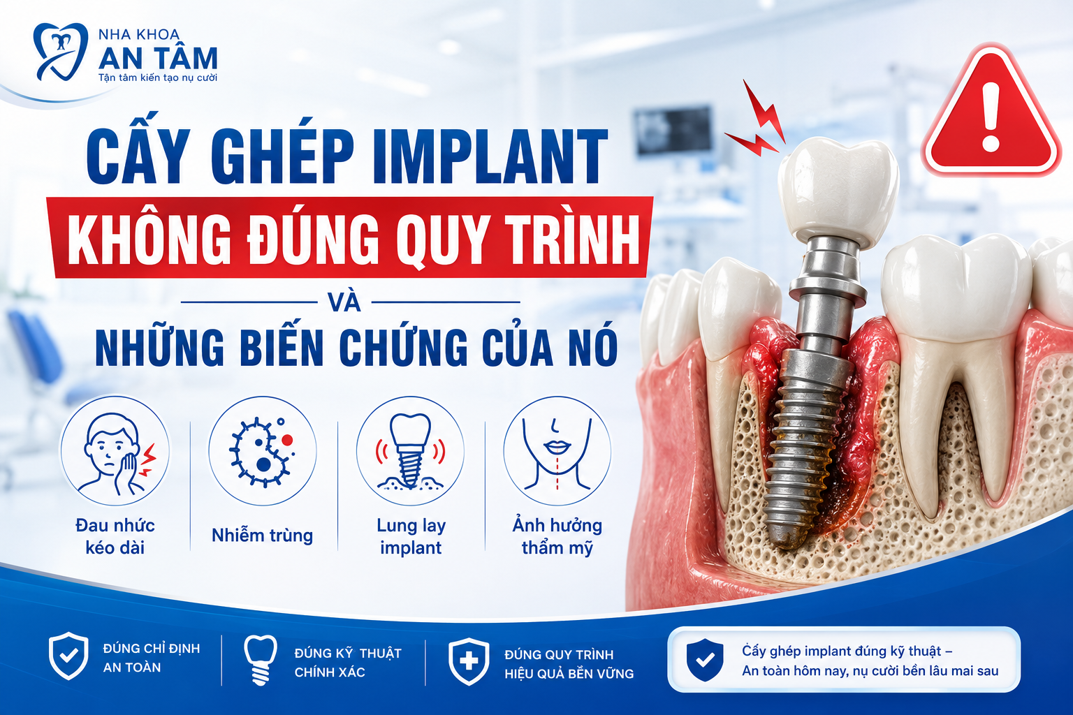 Cấy ghép IMPLANT không đúng quy trình và những biến chứng của nó