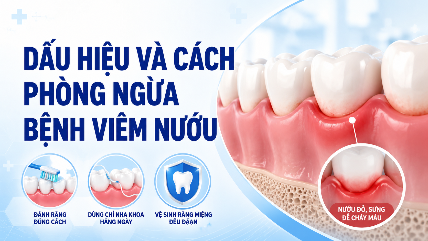 Dấu hiệu và cách phòng ngừa bệnh viêm nướu, bạn cần nên biết!