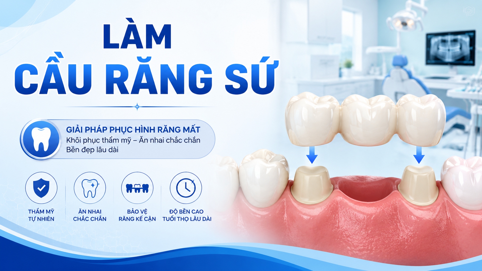 Làm cầu răng sứ