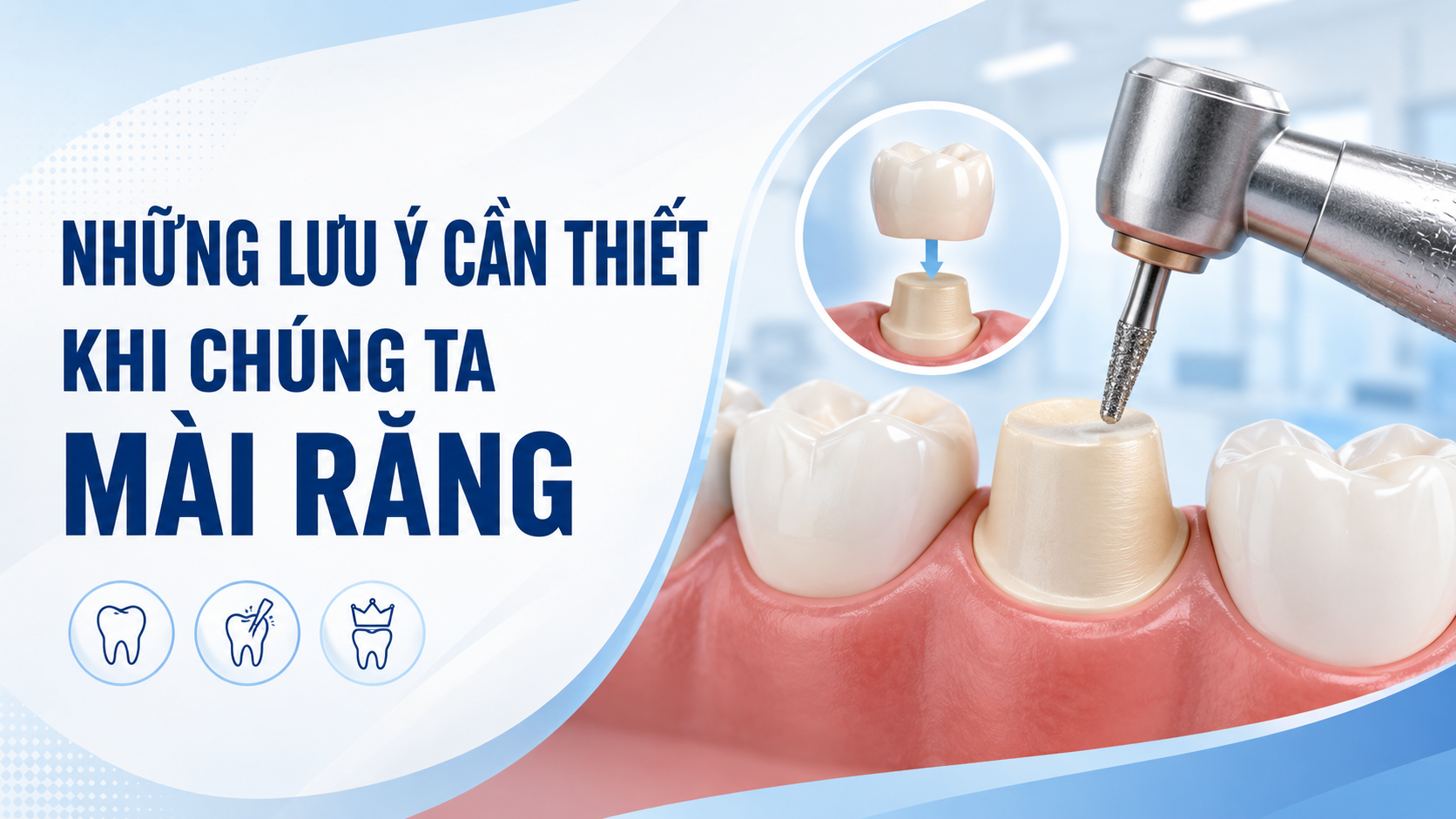 Những lưu ý cần thiết khi chúng ta mài răng